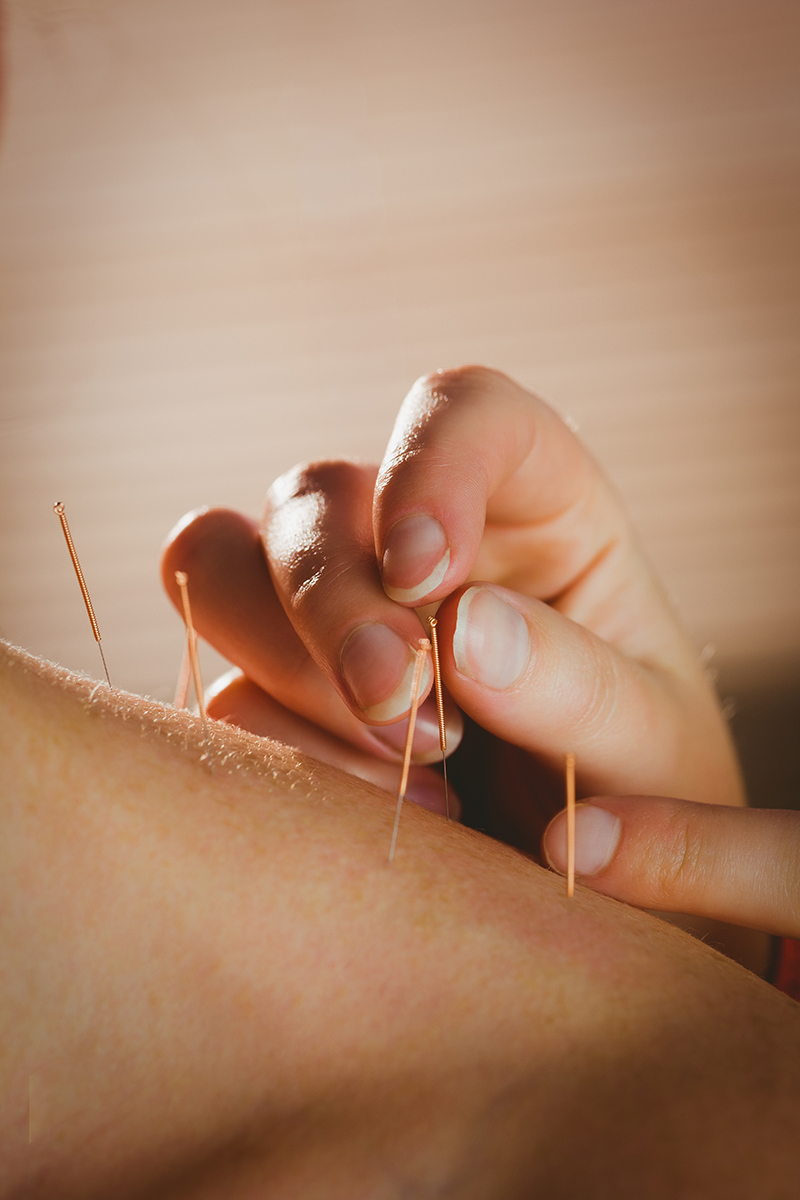 Women's health acupuncture