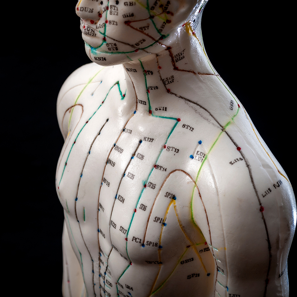 Acupuncture treatment at Jeiran Lashai Acupuncture in Silver Lake