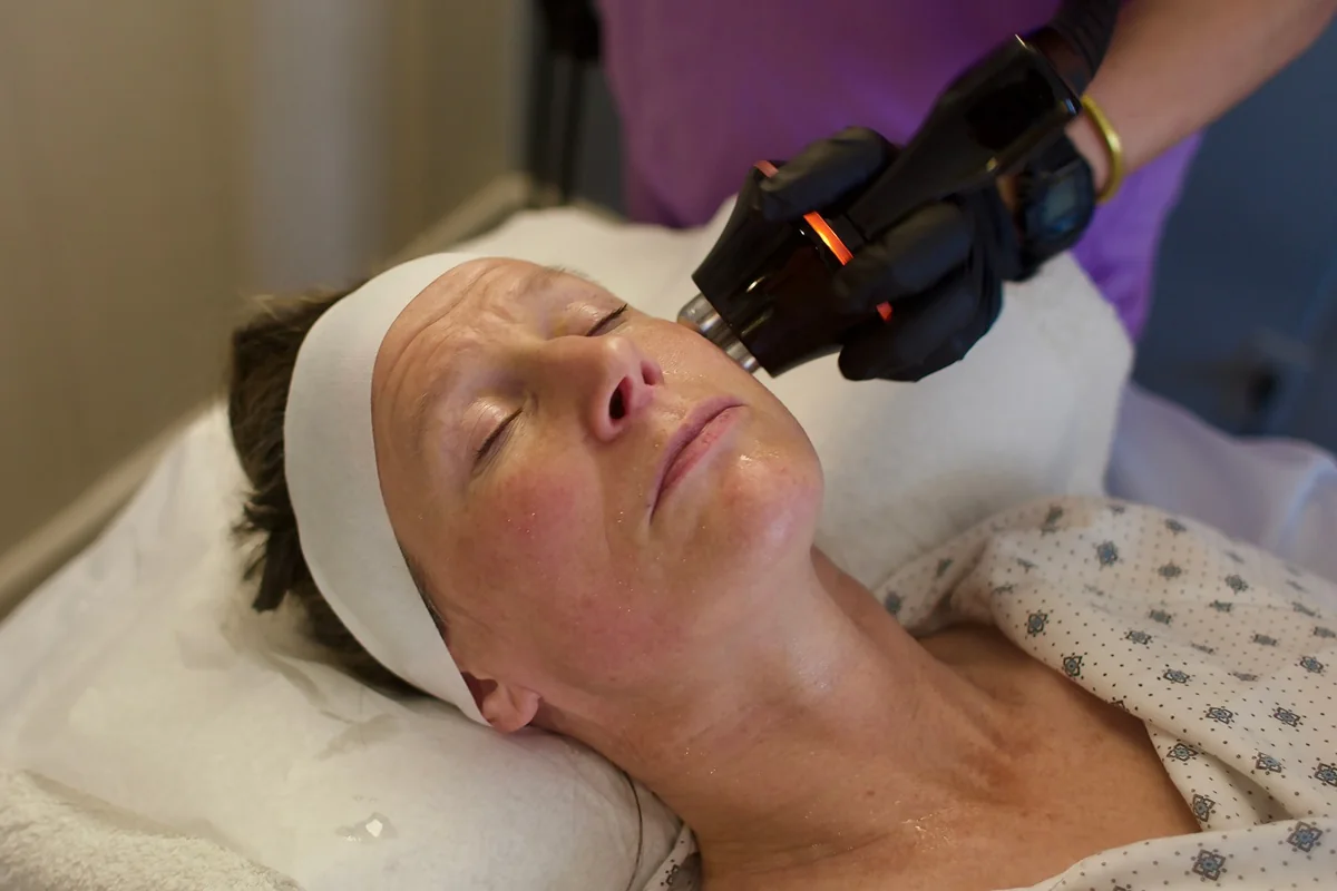 A triLift radiofrequency handpiece guided along a reclined patient's cheek during a combined session